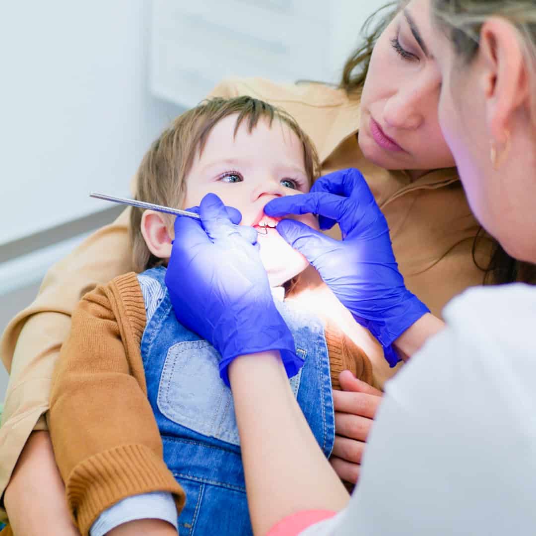 cuidar los dientes de leche