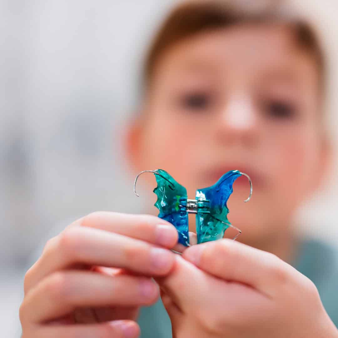 Aparatos de ortodoncia para niños