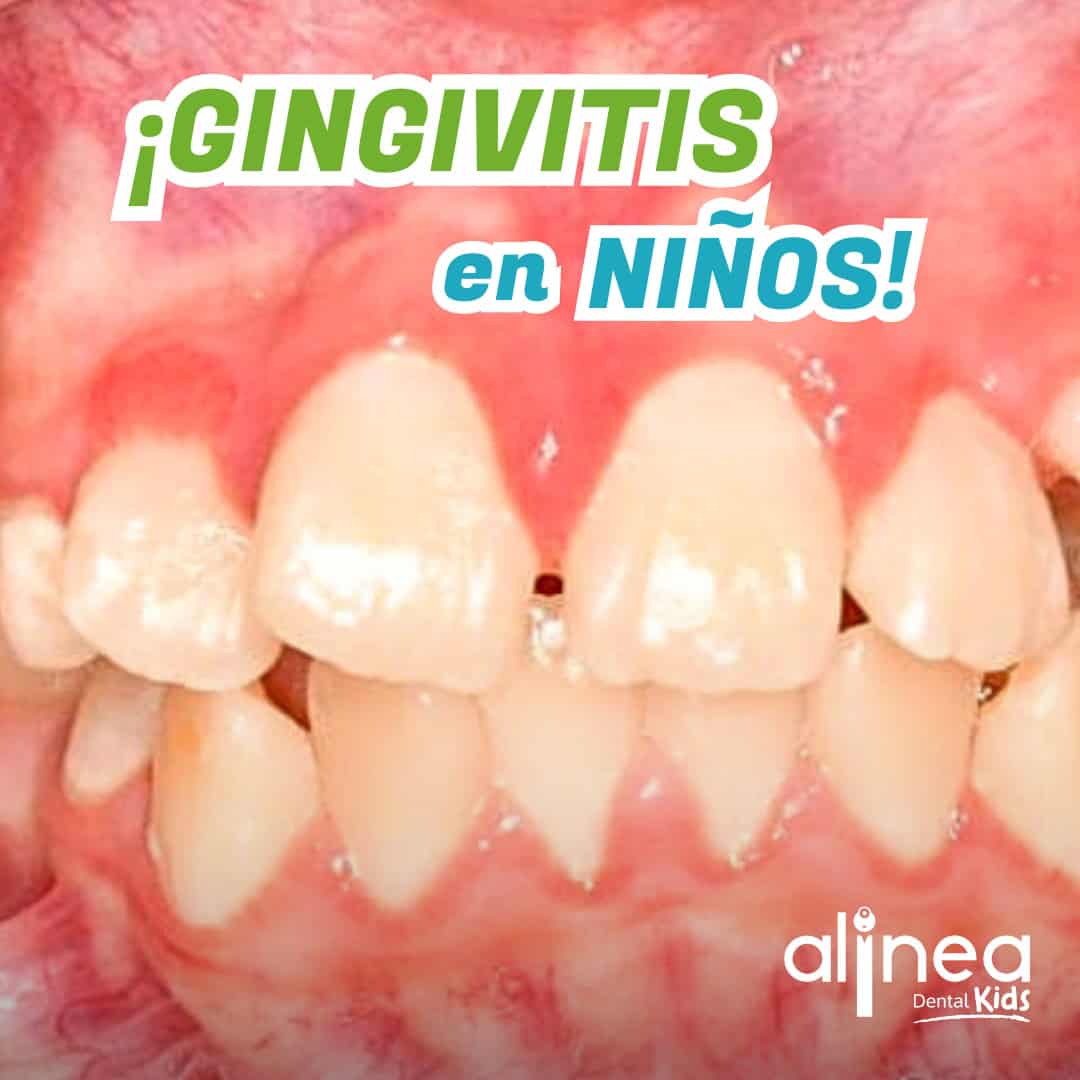 Dentista para niños